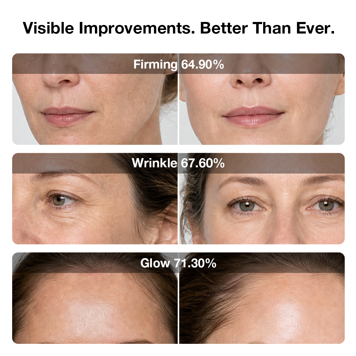JOVS 6D Laser & EMS Anti-Aging Therapy Mask