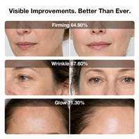 JOVS 6D Laser & EMS Anti-Aging Therapy Mask