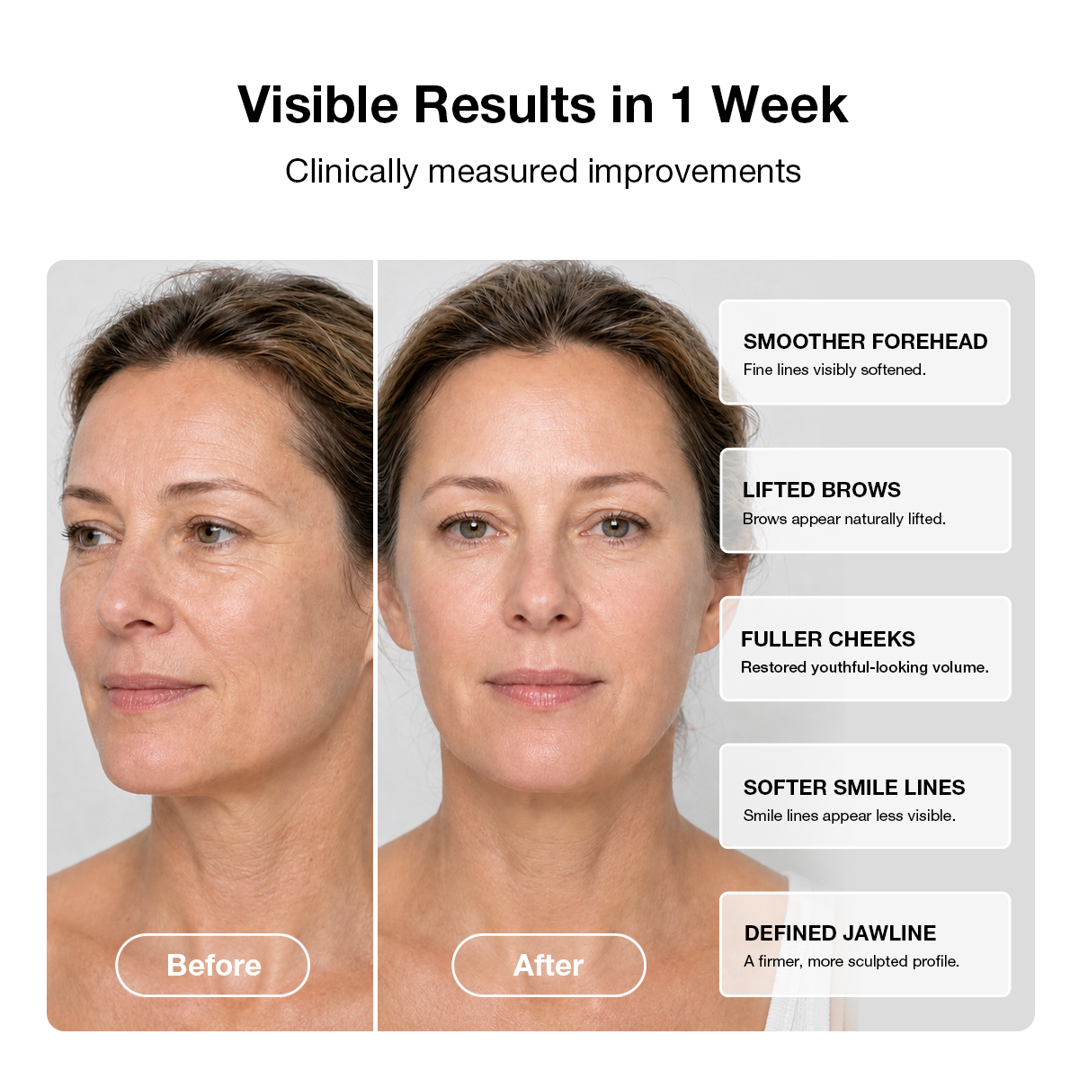 JOVS 6D Laser & EMS Anti-Aging Therapy Mask
